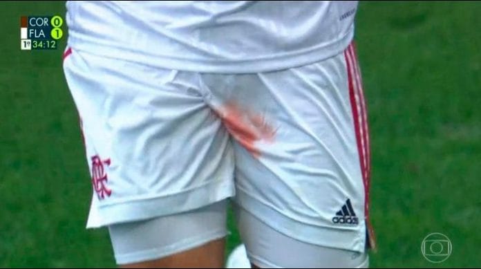 Le sangra un testículo a jugador de fútbol en pleno partido