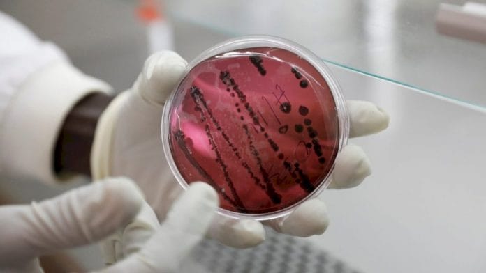 Descubren nuevo brote de virus mortal en Bolivia