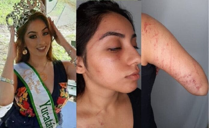 Agreden a 'Miss Turismo Yucatán' en un parque de Mérida