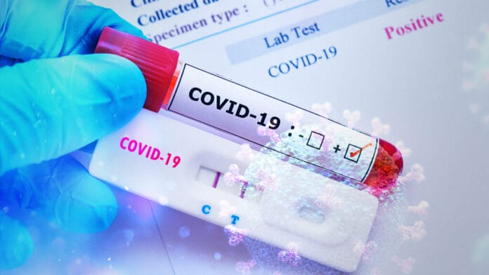 Se cumplen dos años de la llegada del coronavirus a México