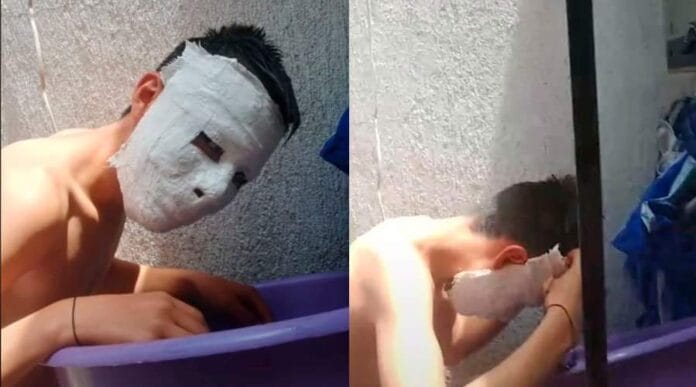 Estudiante hace máscara de yeso de tarea y se le queda pegada en el rostro