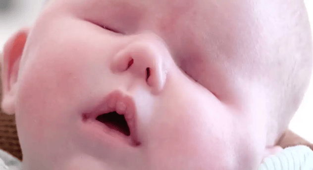bebé sin ojos 2