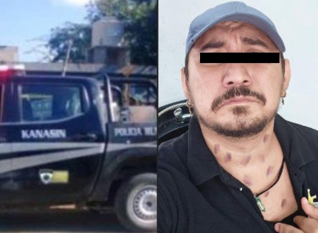 Yucatán. ¡El supuesto Huay Chivo ataca de nuevo! Ahora se fue contra un hombre en Kanasín