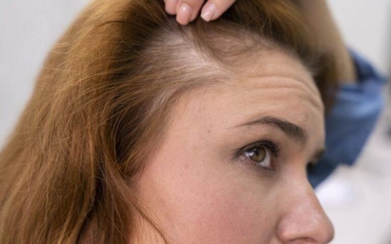 5 remedios caseros  para evitar la caída del cabello en mujeres