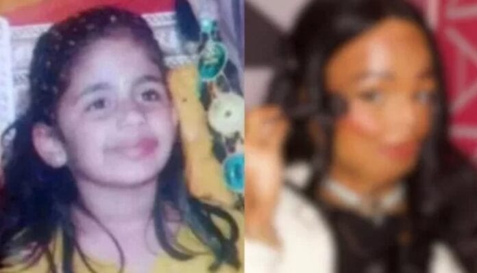 Shampoo antipiojos le cambió la vida a una chiquilla: perdió dedos y parte del rostro