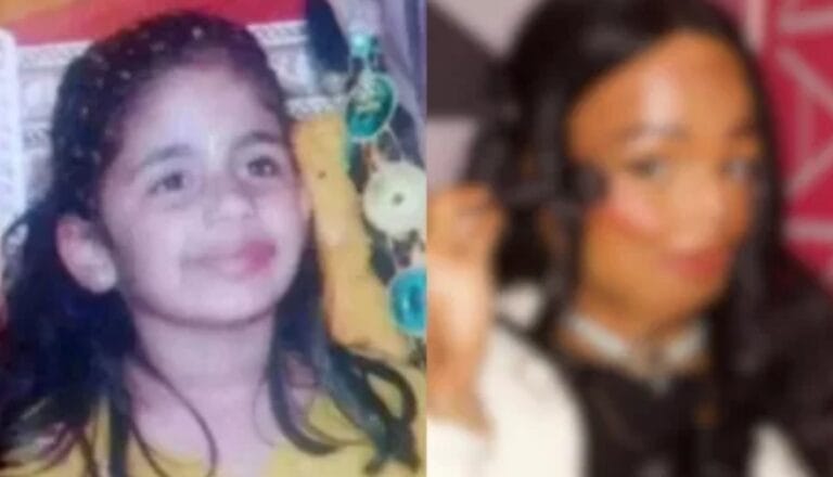 Shampoo antipiojos le cambió la vida a una chiquilla: perdió dedos y parte del rostro