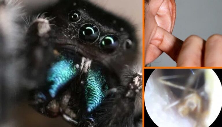 Joven pensó que tenía una infección, pero descubrió que era solo una araña viviendo dentro de su oído (VIDEO)