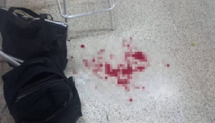 Pánico en secundaria: chavito apuñaló por la espalda a su profesor por no aceptarle una tarea atrasada