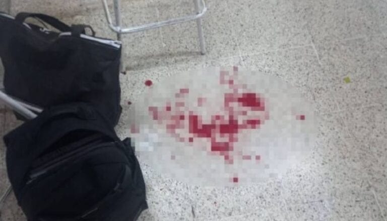 Pánico en secundaria: chavito apuñaló por la espalda a su profesor por no aceptarle una tarea atrasada